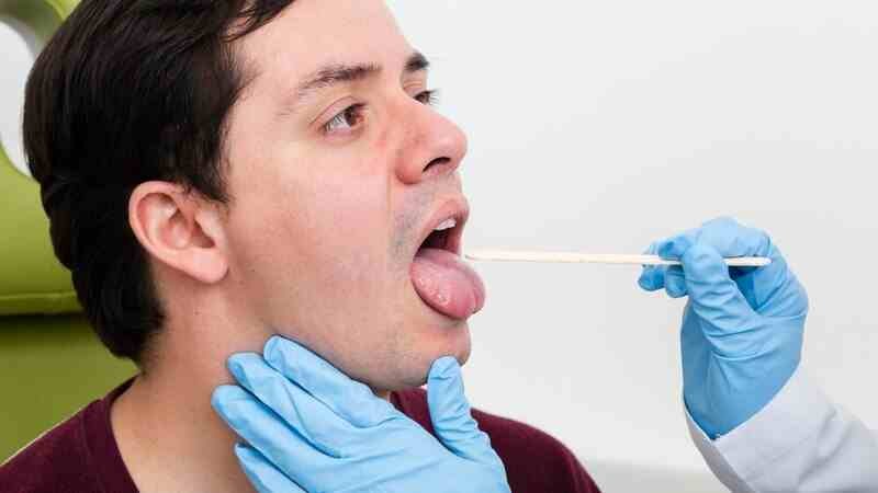 treatment for scalloped tongue