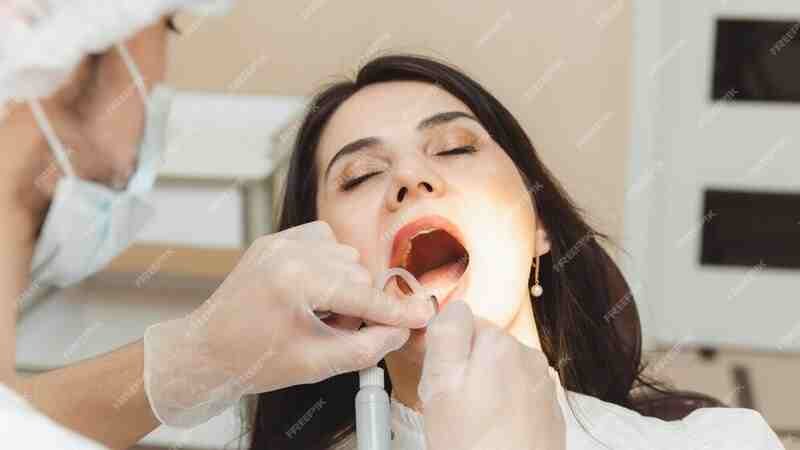 what causes scalloped tongue