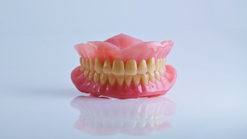 types of upper partial dentures